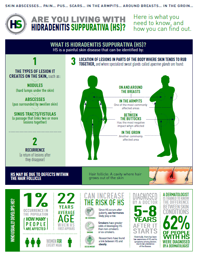 HS info graphic